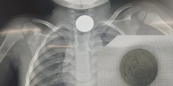 000e6769d4a977f72eb8 2674