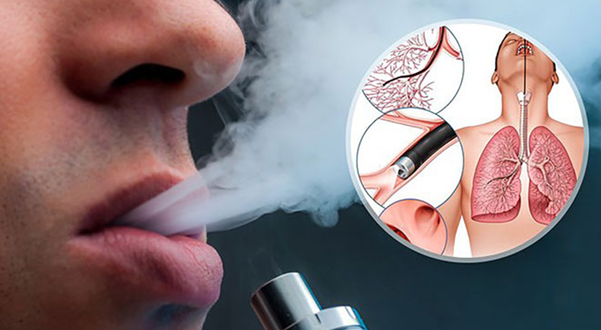 thuopc la dien tu 1775